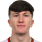 Fitzpatrick